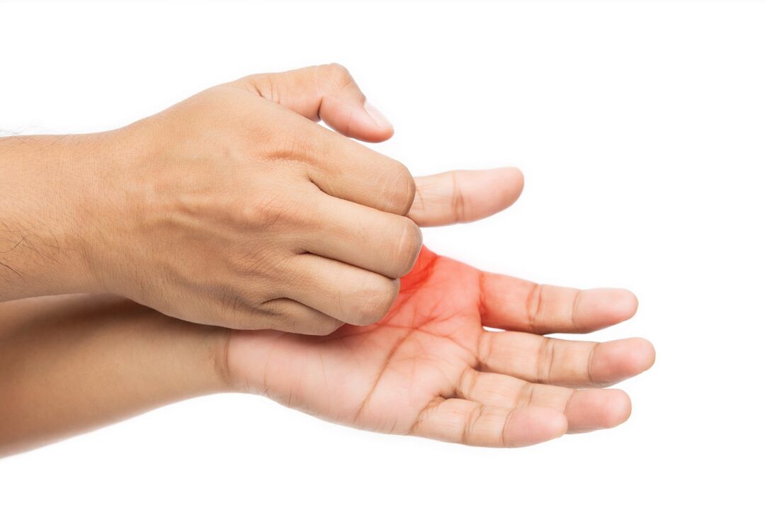 Viszketés a gomba és a Demyxil krémmel történő kezeléssel